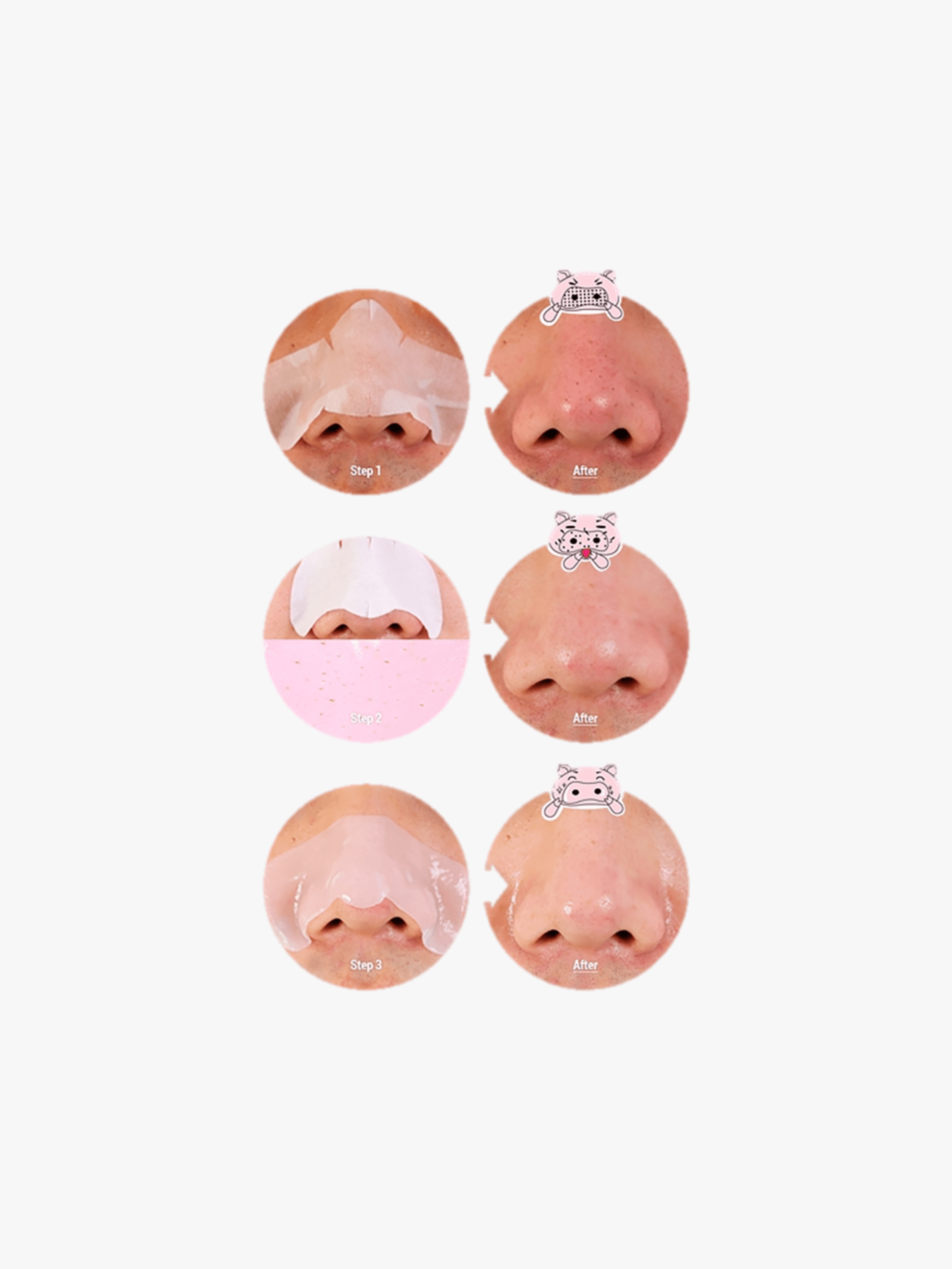 Holika Holika - Patchs points noirs - Pig Nose Clear Blackhead 3-Step Kit