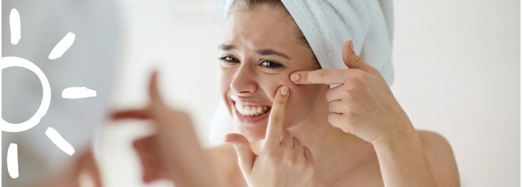 Acné : quels soins et actifs pour lutter contre les imperfections ?