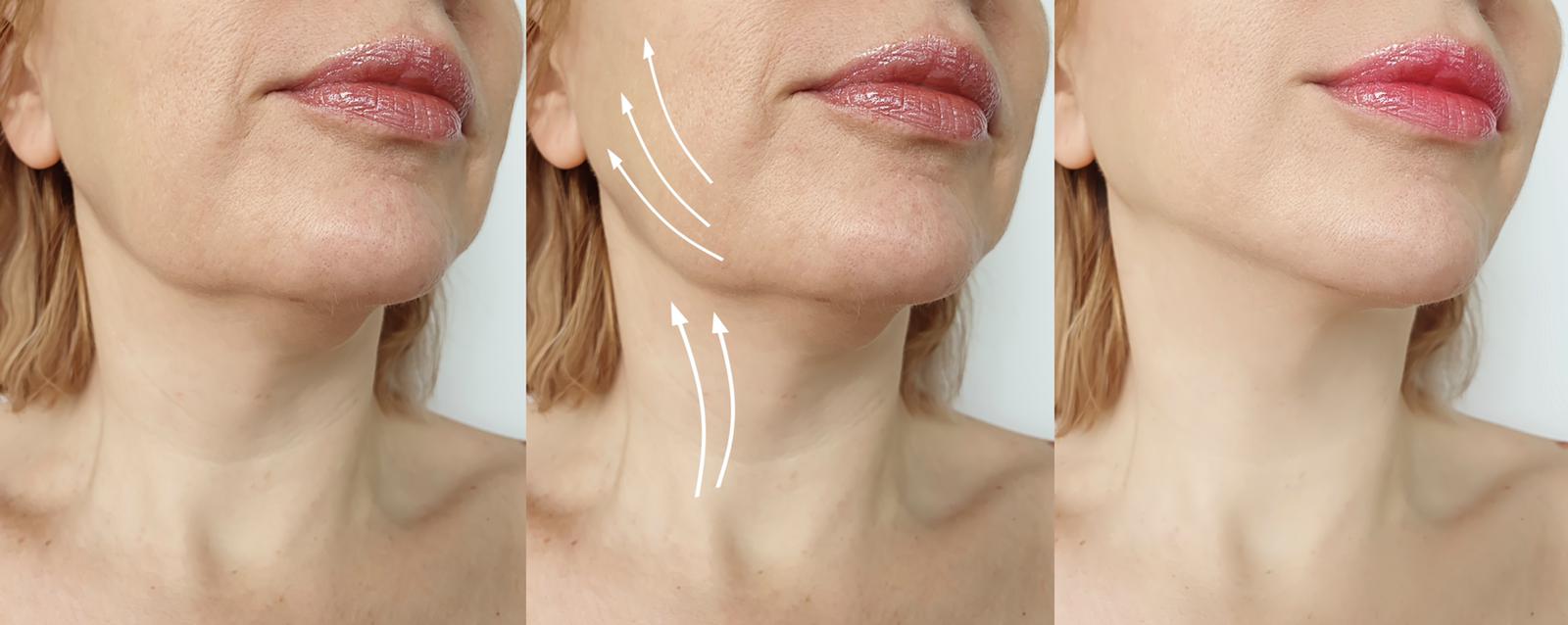 Collagène : quels sont ses bienfaits pour la peau ?