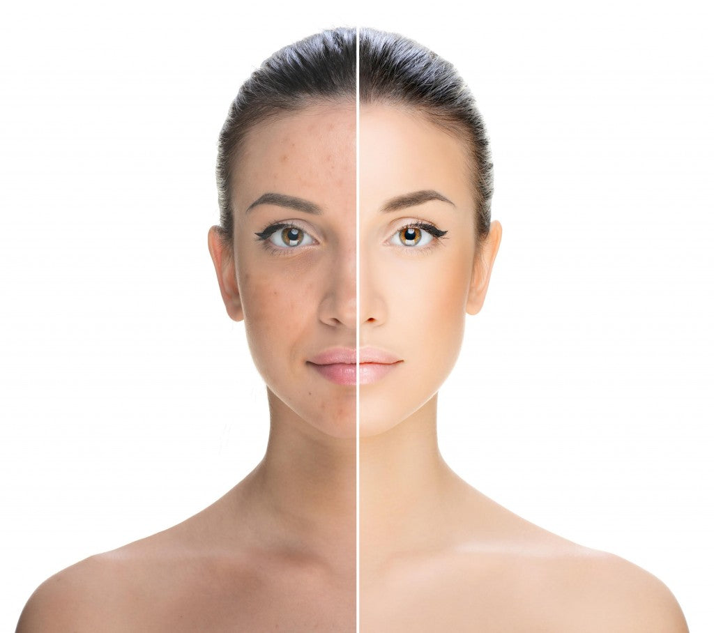 Teint terne : que faire pour retrouver une peau éclatante ?